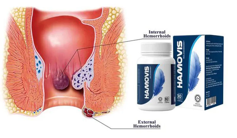 Hamovis